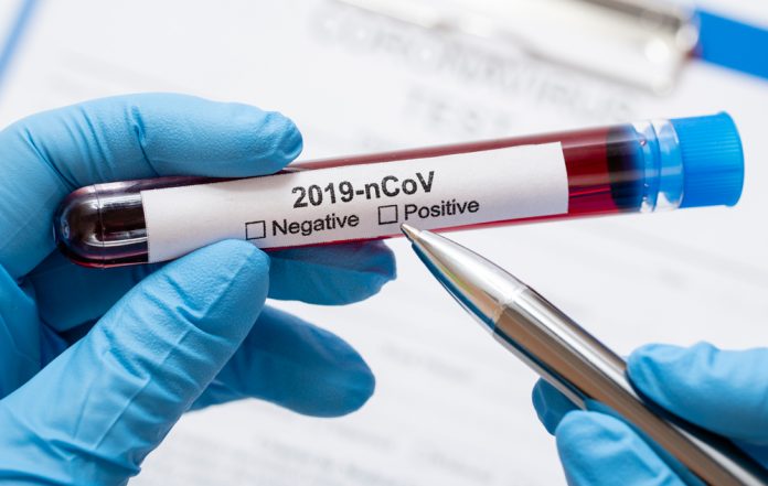corona virus positive