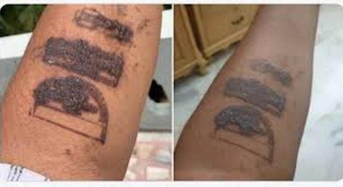 stamp